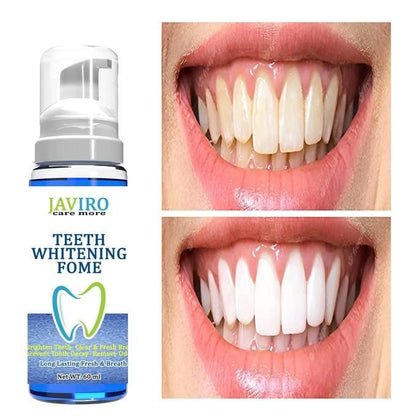 Teeth Whitening Fome (60 ML)